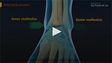 Foot and Ankle Anatomy Video